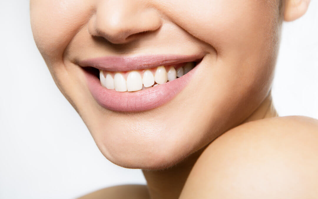 Have Yellow Teeth? Here Are 5 Benefits of Teeth Whitening