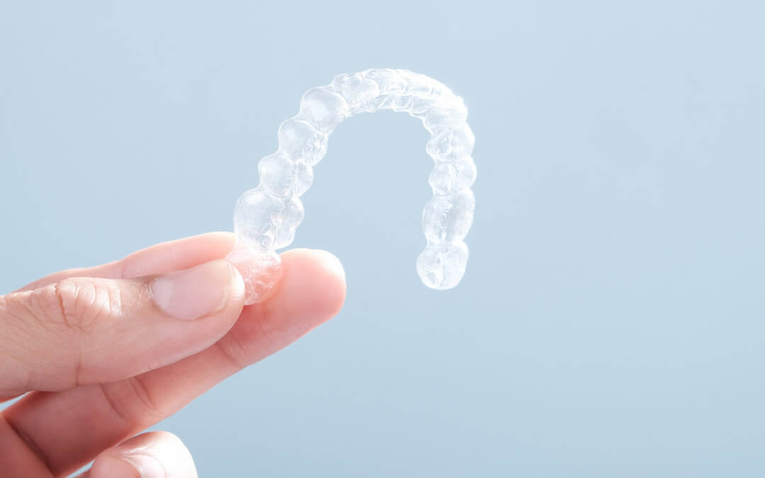 How Does Clear Aligner Therapy Work? What You Need to Know